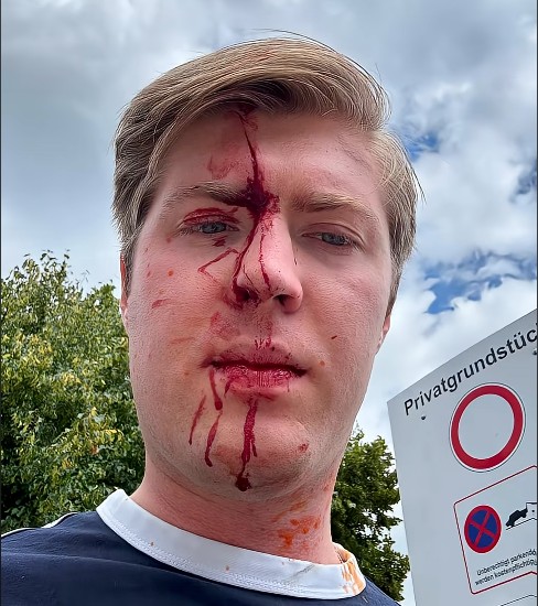 Angriff auf „Generation Deutschland“-Vertreter: Videoaufnahmen und Aussagen werfen Fragen&nbsp;auf
